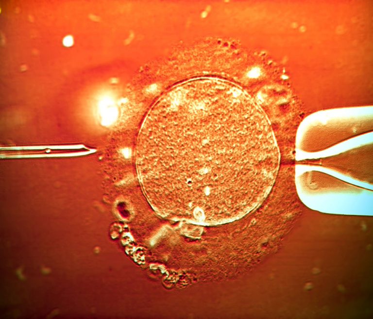 Bambini nati con l' IVF
