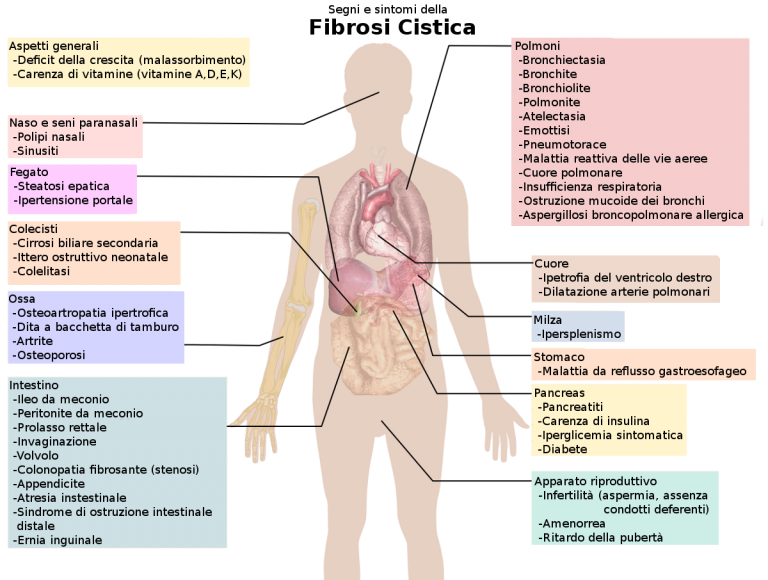 Cystic fibrosis manifestations it