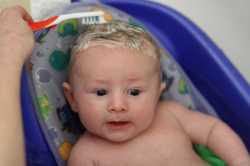 Crosta lattea: come rimuoverla dalla testa del bambino?