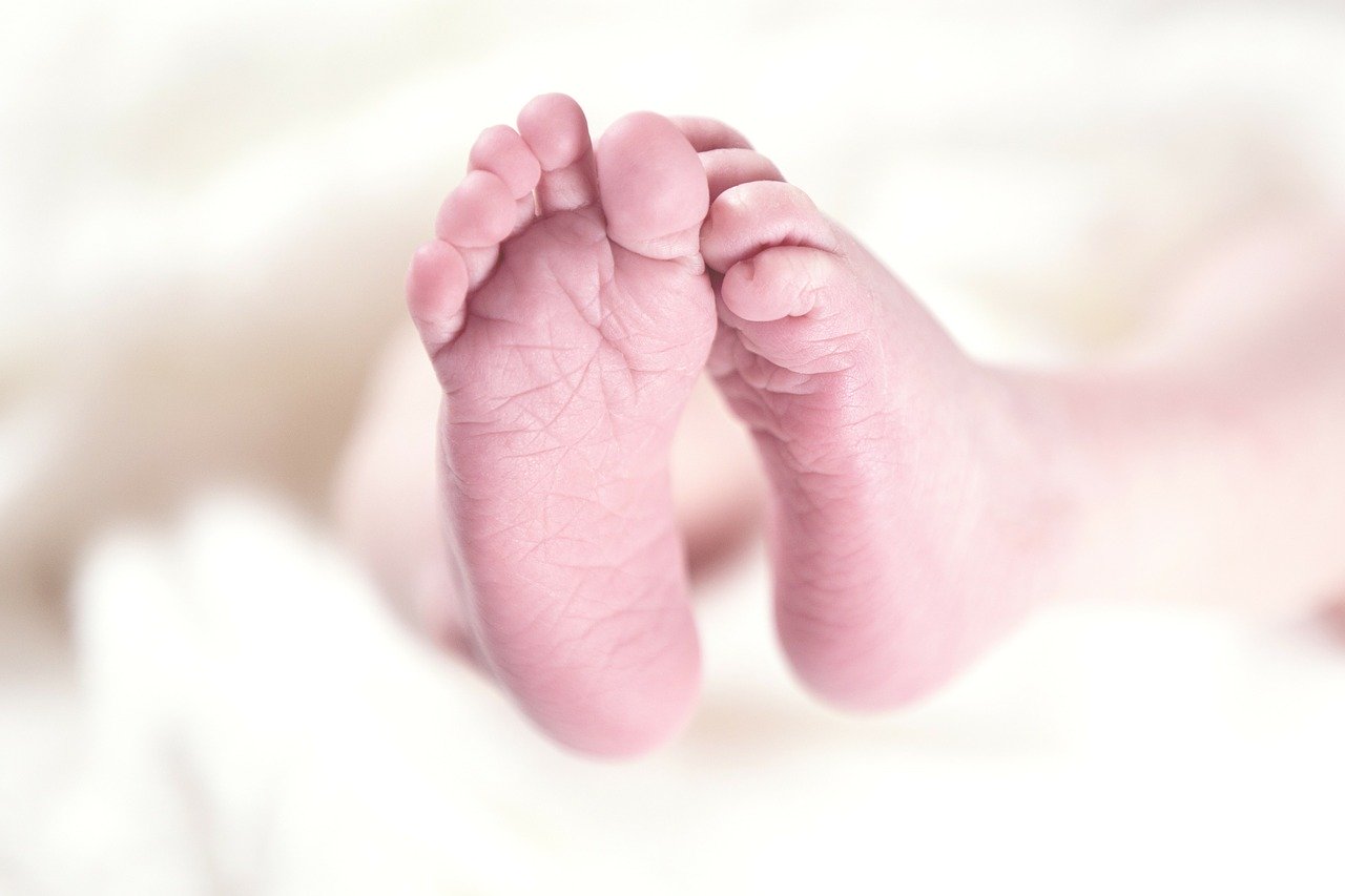 le cause del piede torto nel neonato