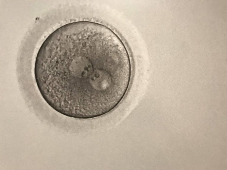 lo sviluppo dell'embrione in gravidanza