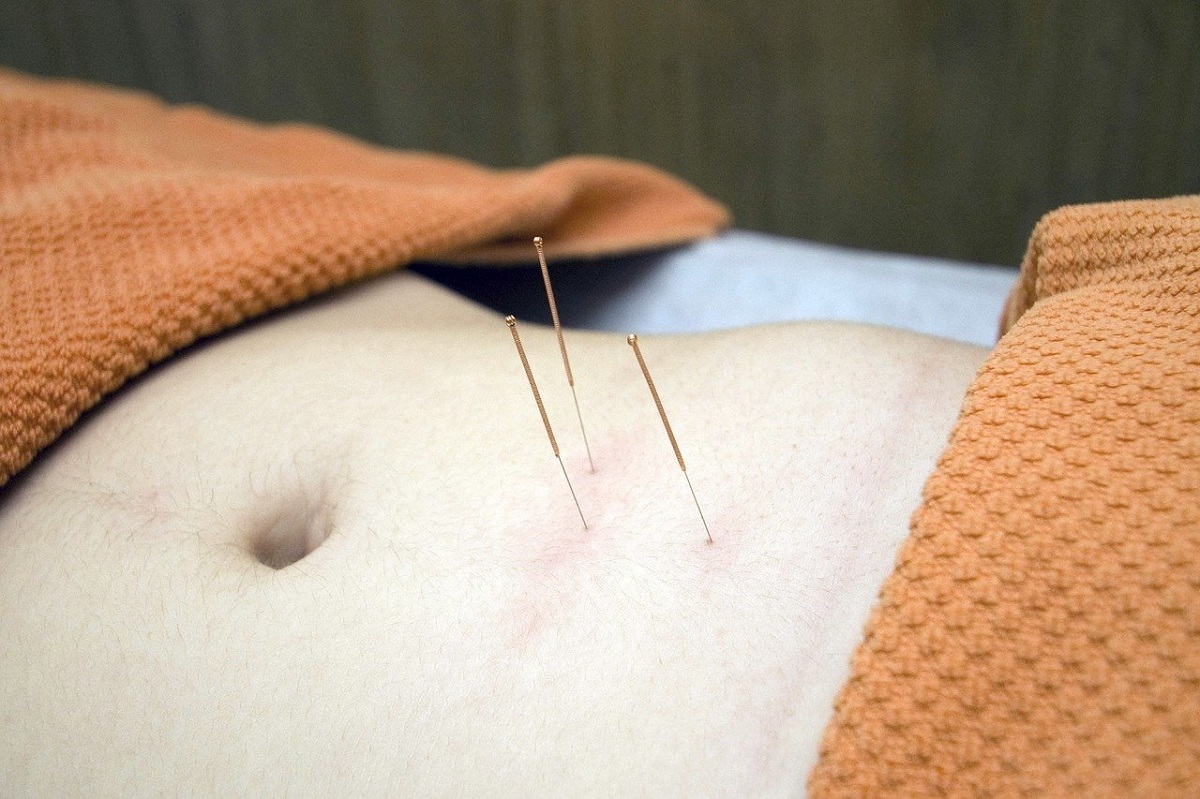 Agopuntura in gravidanza