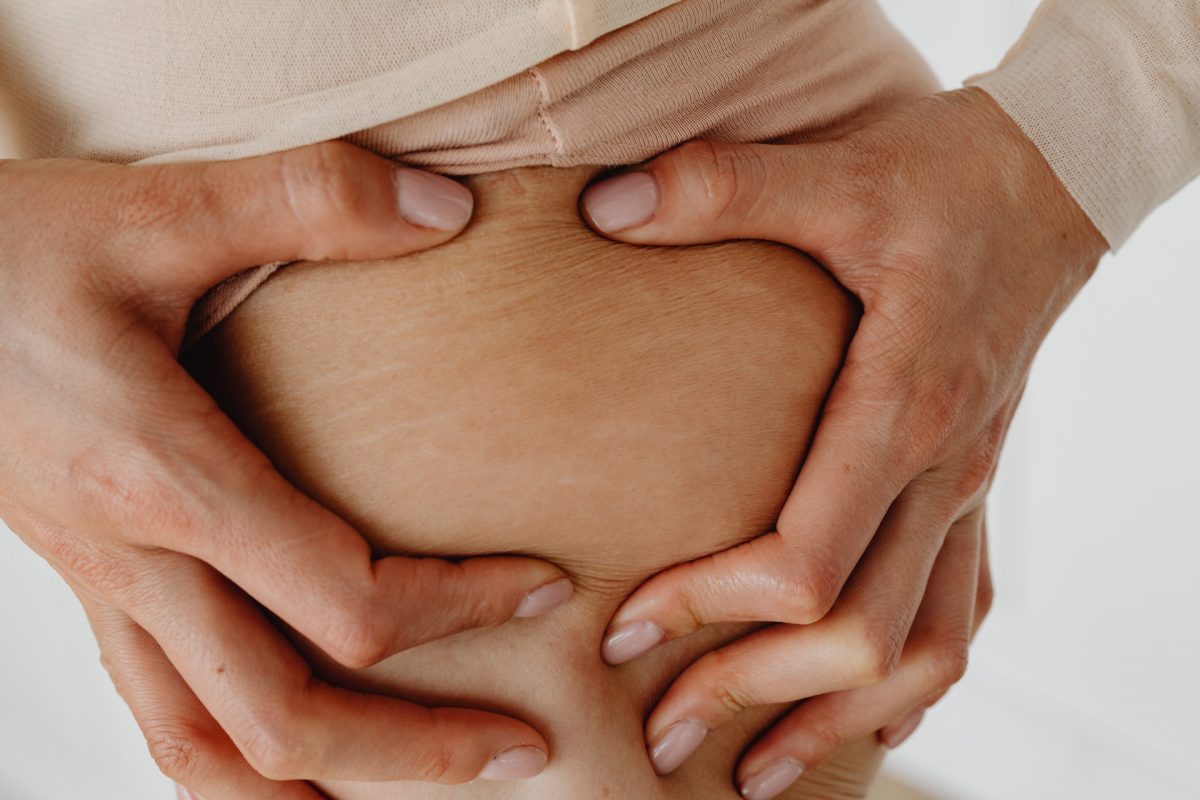 Smagliature in gravidanza rimedi