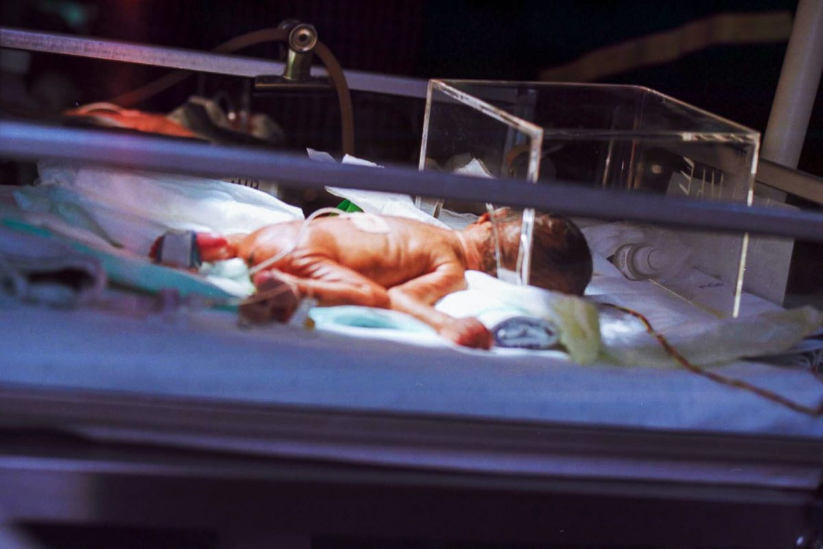 Bambino in terapia intensiva neonatale