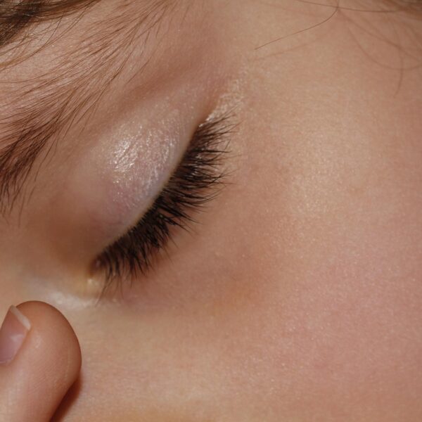 Meningite e disinformazione: dieci cose da sapere