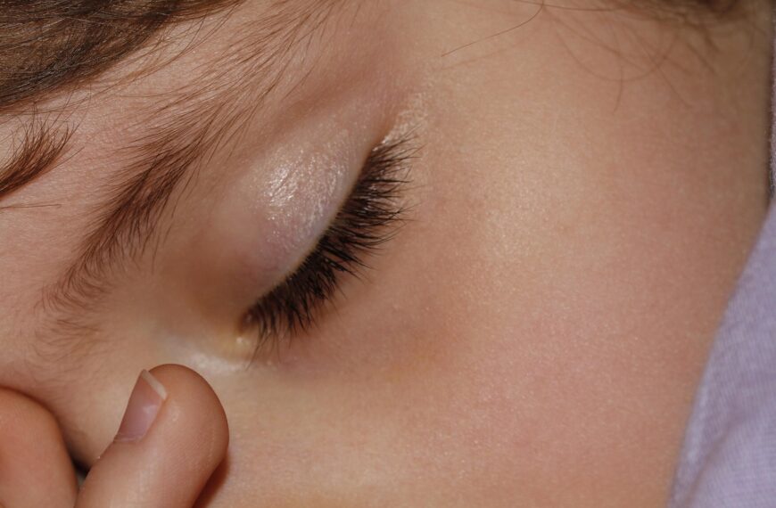 Meningite e disinformazione: dieci cose da sapere