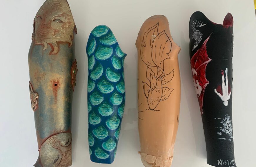 Trovare la bellezza nel dolore: gli studenti d’arte che trasformano le protesi destinate a disabili
